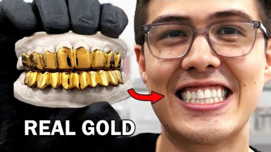 ⁣Making custom gold grillz